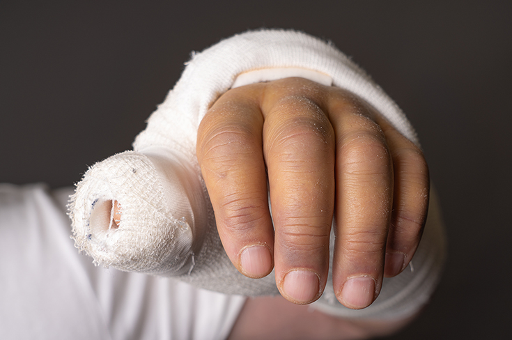 В Москве врачи восстановили мальчику оторванную часть пальца