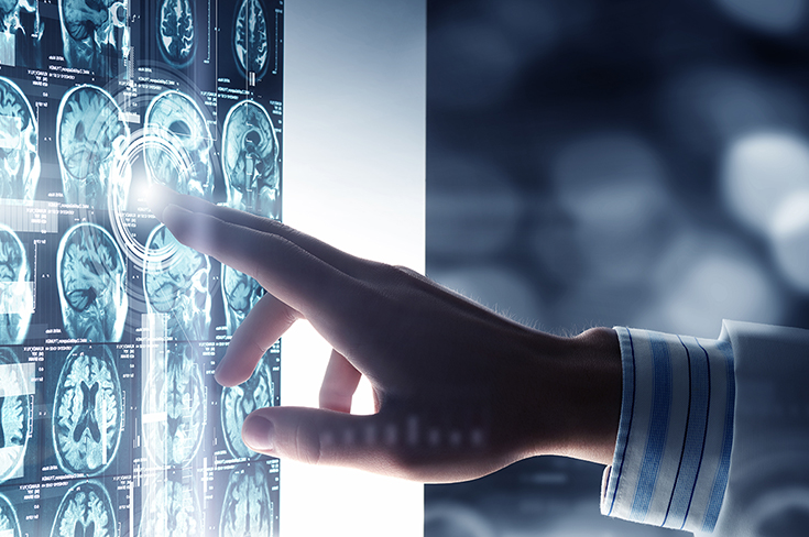 Первую в России операцию с помощью уникального экзоскопа провели хирурги Склифа: это прорыв в оперировании головного мозга