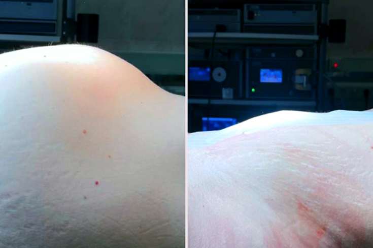 Гинекологи больницы Ерамишанцева удалили у женщины опухоль весом 5 кг