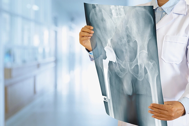 В больнице им. В.В. Виноградова бывший студент спас жизнь своему преподавателю